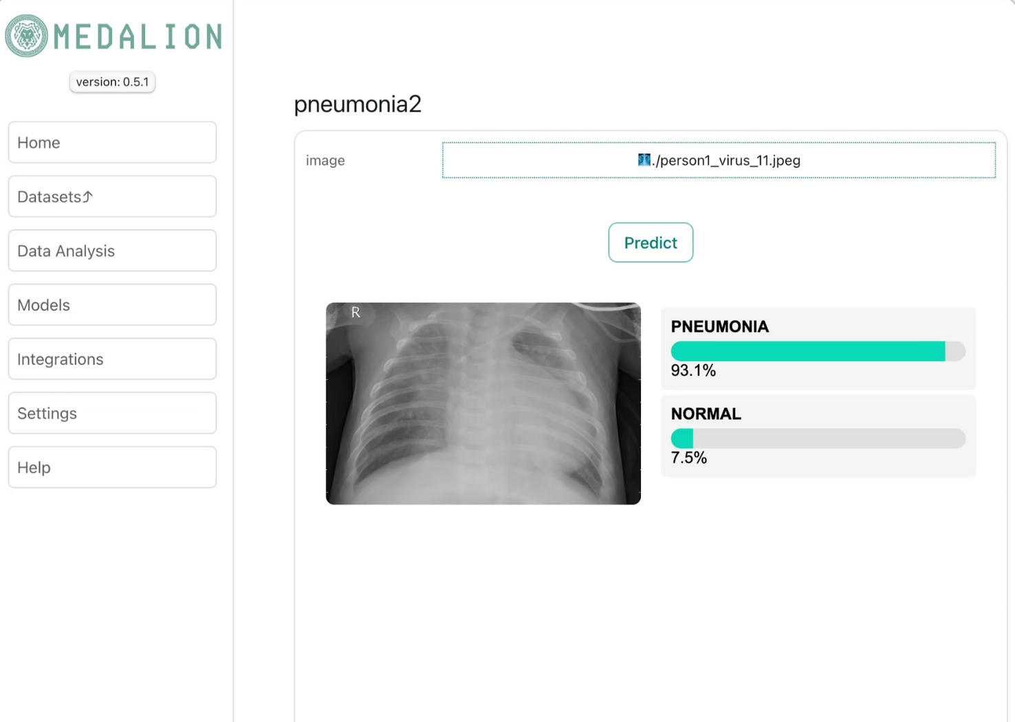 Interfejs analizy obrazów medycznych
