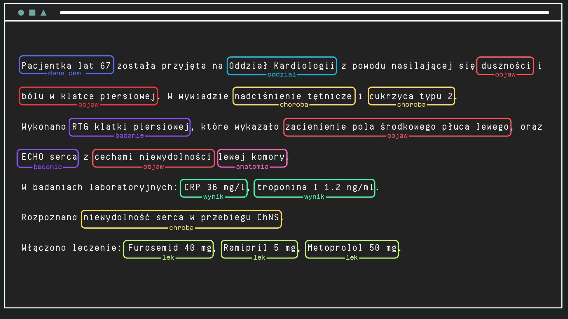 MedalioNER - Zaawansowany model rozpoznawania nazwanych encji (NER) specjalistycznie wytrenowany na polskich tekstach medycznych. Automatycznie identyfikuje i klasyfikuje 11 typów kluczowych informacji medycznych w dokumentacji lekarskiej.